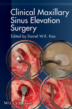 Clinical Maxillary Sinus Elevation Surgery, edited by Daniel W.K. Kao